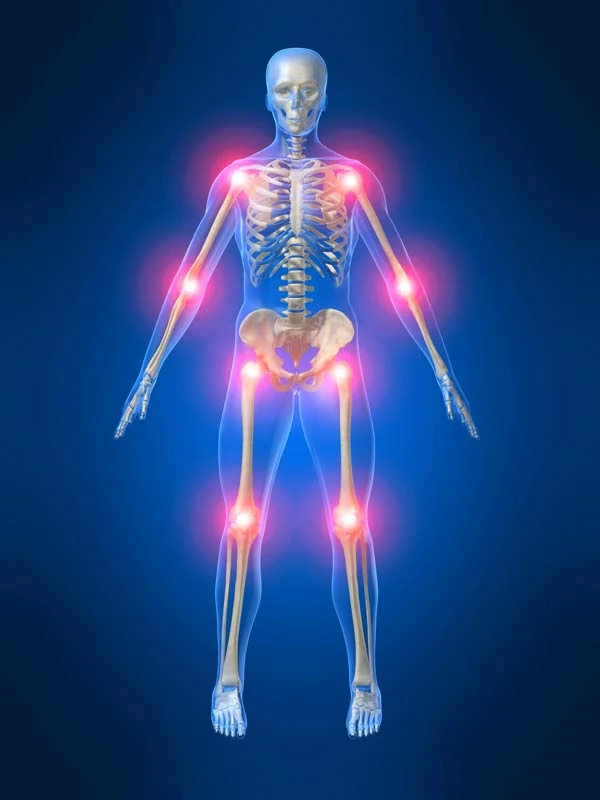 arthritis-treatment-in-jupiter