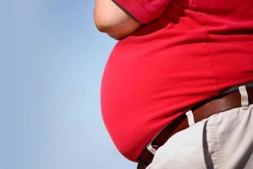 OBESITY